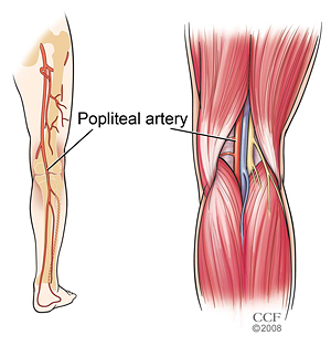 Anatomical location of the popliteal artery (source)