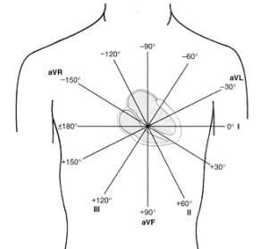 Electrocardiograms (EKGs/ECGs): Determining Axis Deviation - Stepwards