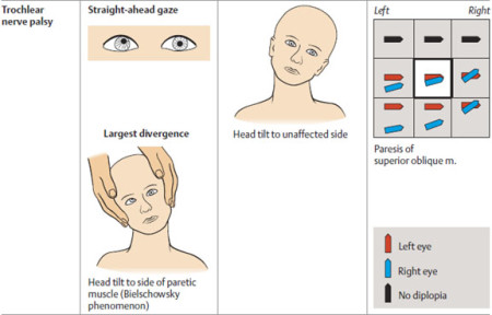 A Guide To The Cranial Nerves - Stepwards