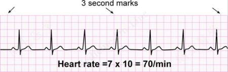 Electrocardiogram Guide (EKG/ECG) - Stepwards