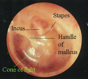 Head, Eyes, Ears, Nose, & Throat (HEENT) exam - Stepwards