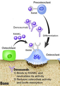 Denosumab - Stepwards