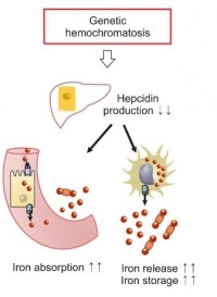 Hemochromatosis - Stepwards