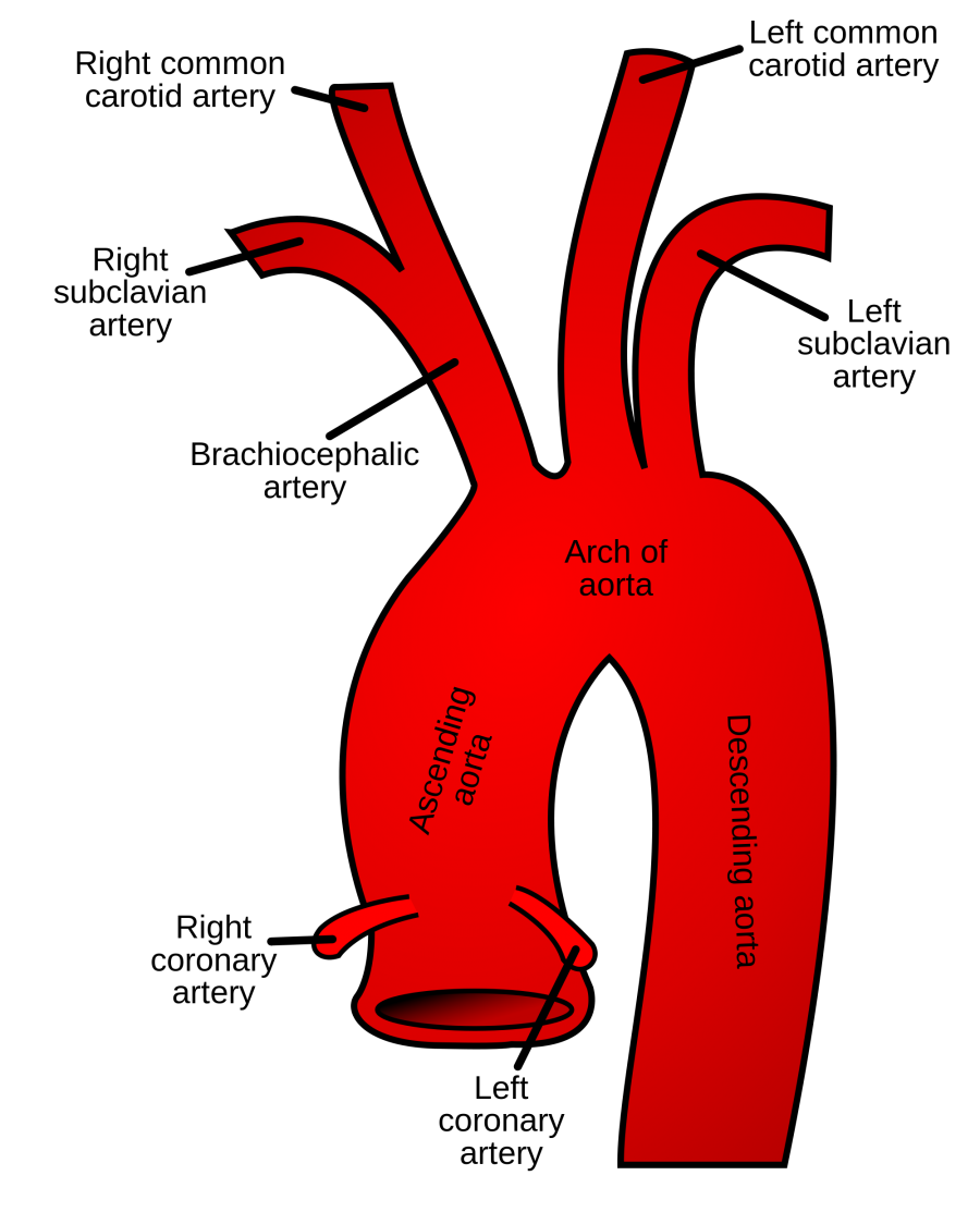 Brachiocephalic Artery - Stepwards