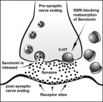 Citalopram - Stepwards