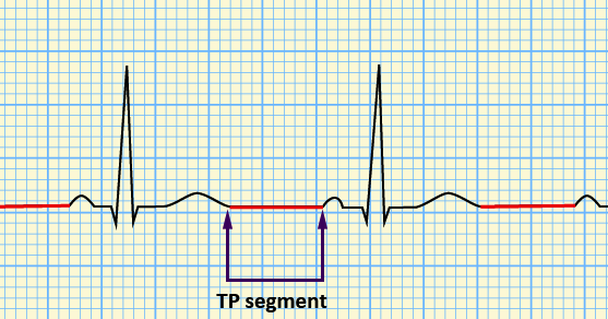 TP segment - Stepwards