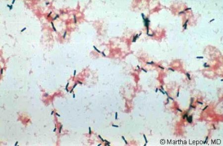 Listeria Monocytogenes - Stepwards