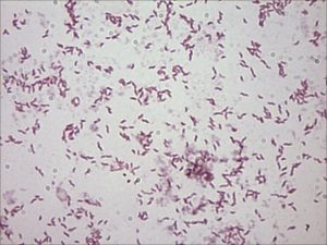 Campylobacter Jejuni - Stepwards