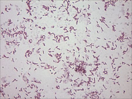 Campylobacter Jejuni - Stepwards