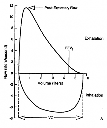 Flow Volume Loops: A Critical Analysis - Stepwards