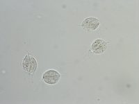 Trichomoniasis - Stepwards