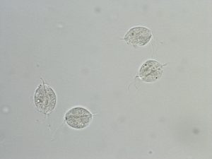 Trichomoniasis - Stepwards