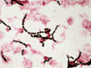 Streptococcus Agalactiae - Stepwards