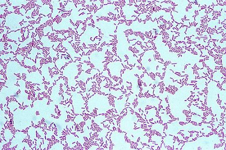 Pseudomonas Aeruginosa - Stepwards