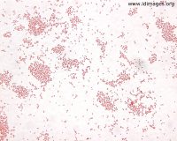 Bordetella pertussis - Stepwards