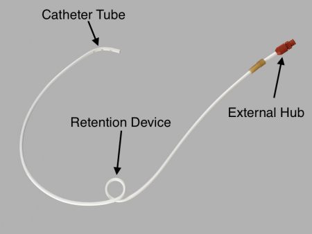 Anatomy Of Percutaneous Feeding Tubes - Stepwards