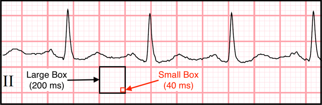 Electrocardiograms (EKGs/ECGs): Determining The Heart Rate - Stepwards